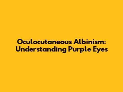 Oculocutaneous Albinism: Understanding Purple Eyes
